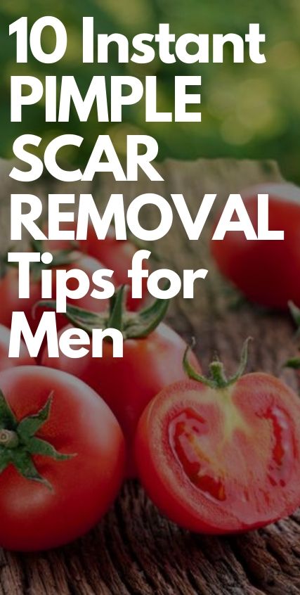 10 Instant Pimple Scar Removal Tips for Men 10 Instant Pimple Scar Removal Tips for Men