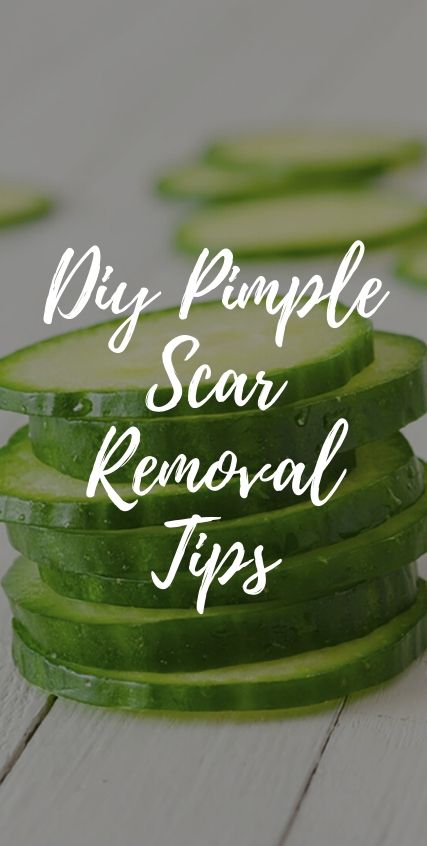 DIY PIMPLE SCAR REMOVAL TIPS DIY PIMPLE SCAR REMOVAL TIPS
