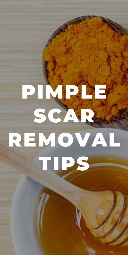 PIMPLE SCAR REMOVAL TIPS PIMPLE SCAR REMOVAL TIPS