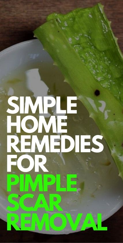 Simple Pimple Scar Removal Tips for Men Simple Pimple Scar Removal Tips for Men